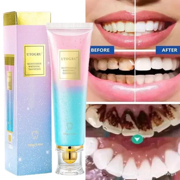UTOGRU Whitening Toothpaste  – Teeth Brightening & Fresh Breath Formula