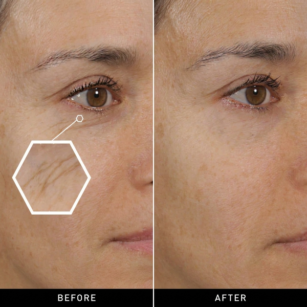 Botox Bee Venom Wrinkle Cream – Anti-Aging & Collagen Boosting Moisturizer for Firm, Tight, and Hydrated Skin – alternate view